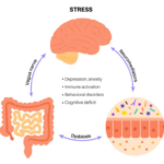 Stress and gut health