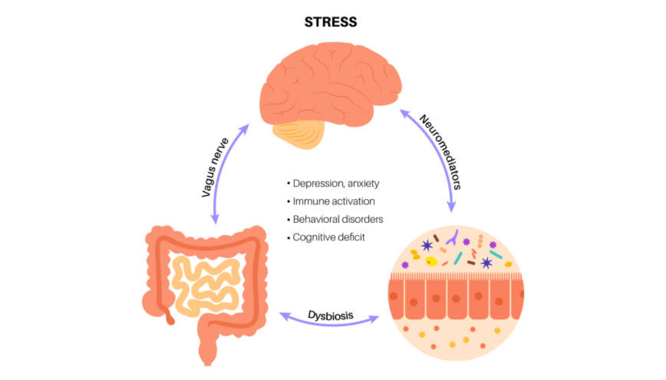 Stress and gut health